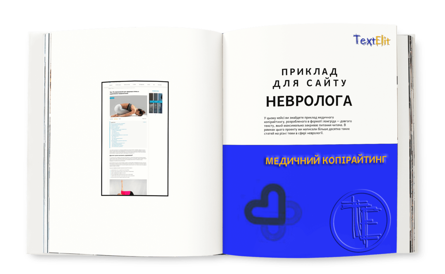Приклад медичного копірайтингу для сайту невролога