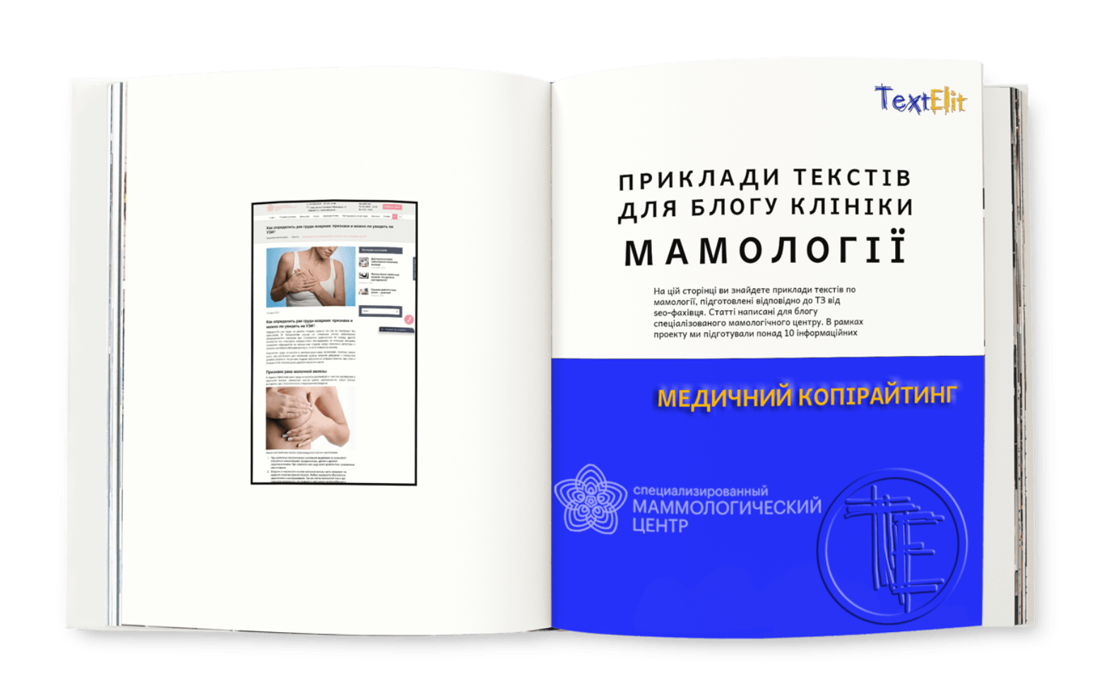 Приклади текстів по мамології для блогу клініки